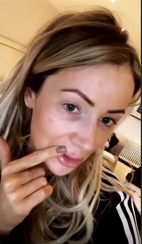 olivia attwood topless|Olivia Attwood shares completely nude snap as she strips off to。